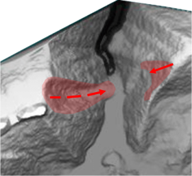 Coğrafi Bilgi Sistemleri ve Uzaktan Algılama Teknikleri ile Haritalama ve Analiz